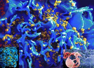 Researchers shown that anti-cancer immunotherapy be use to fight HIV