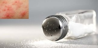 Salt apparently affects allergic immune reactions