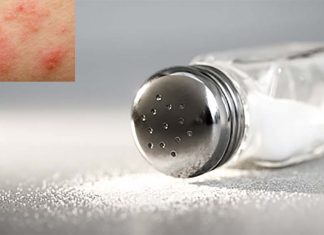 Salt apparently affects allergic immune reactions