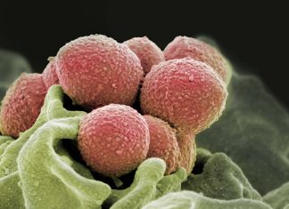 Group A streptococcus causes more than 700 million cases of human infection every year globally