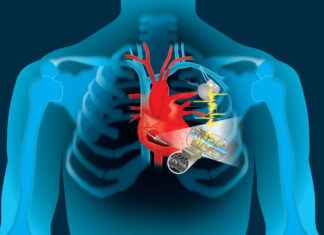 The heart’s motion is so powerful that it can recharge devices that save our lives