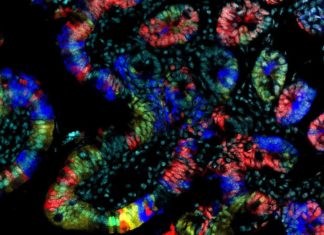 Researchers have discovered a mechanism which is used by the body to protect intestinal stem cells from turning cancerous