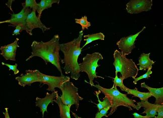 Tropoelastin has been found to encourage stem cell growth