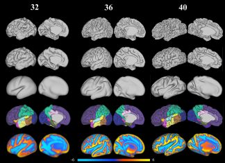 A new map of newborn babies’ brains may aid early detection of autism