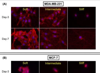 A study provides new insight into how the stiffening of breast tissue plays a role in breast cancer development