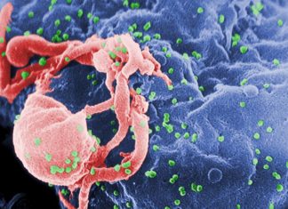 Researchers are one step closer to using the chickenpox virus to develop a vaccine against HIV