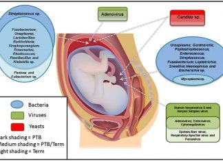 N-acetylcysteine (NAC) drug may protect baby from hazards of intraamniotic infections