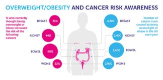 Increase in the rate of obesity-linked cancers among young adults in the United States