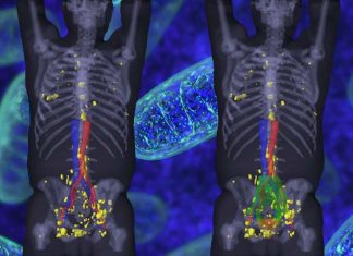 Men with prostate cancer can safely undergo higher doses of radiation