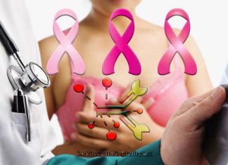 A new “smart drug” has shown promise for women with metastatic triple-negative breast cancer