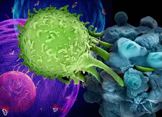 A new study sheds light on one way tumors may continue to grow despite the presence of cancer-killing immune cells