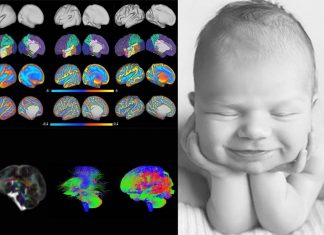 AI use MRI images take at birth to accurately predict an infant’s cognitive development at age two