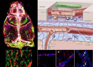 After an infection the immune cell landscape in the brain lining changes