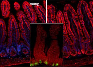 Aging takes a toll on intestinal stem cells and contribute to increased the disorders of the gastrointestinal tract