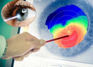 An adhesive gel can seal cuts or ulcers on the cornea