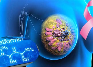 Breast cancer patients : medications may mitigate side effects of chemotherapy