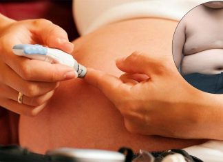 Children born to mothers with gestational diabetes are at risk to become obese children