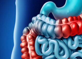 Crohn’s disease: the challenge is separating out potential causes