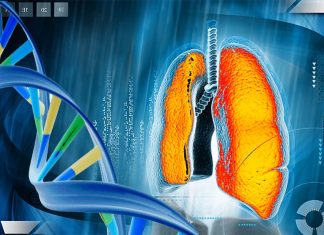 Cystic fibrosis (CF) – Researchers found a potential new diagnostic tools