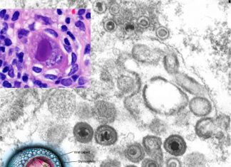 Cytomegalovirus (CMV) infection can convert a harmless, inhaled protein antigen into an allergen