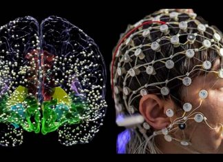 Electrical brain stimulation to treat people diagnosed with major depression