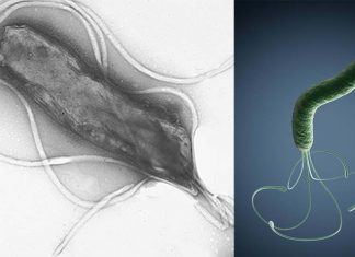 Helicobacter pylori can cause stomach cancer