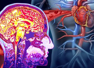 Less healthy brains linked to smoking, high blood and pulse pressures, obesity and diabetes