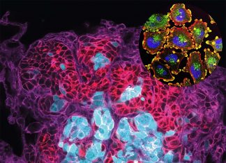 Metastatic cancer cells leave tumors and travel in clusters