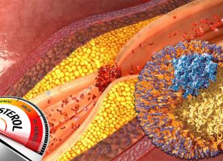 New class of drugs helps block synthesis of artery-clogging cholesterol
