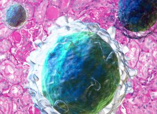 New effective strategy to treat Lupus