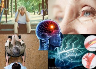New evidence of visual problems linked to acute stroke survivors