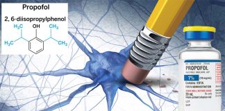 Propofol can muddle memories of specific incidents