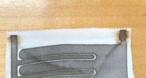 Electroceutical bandages kill bacteria around a wound allowing wounds to heal faster