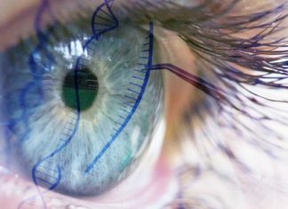 Regain sight with gene therapy it’s possible !