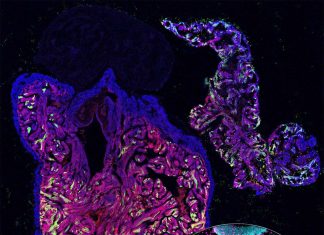 Thyroid Hormones Halt Heart Cell Regeneration