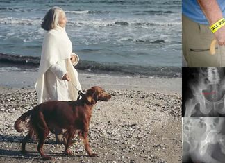 Seniors’ Bone fractures increasing while walking a dog