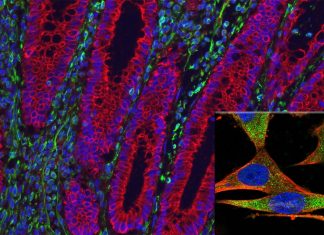 Researchers have found a compound that may treat Crohn’s without directly targeting inflammation