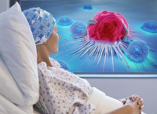 Treat the cancer as fast as you can