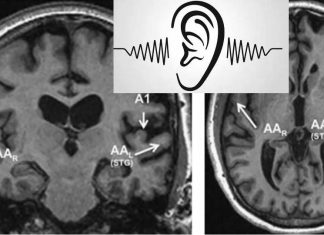 Scientists identify an area in the left brain that seems specialized to process auditory words
