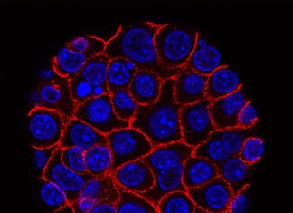 Breast cancer cells require the nutrient pyruvate