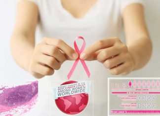 Breast cancer : women living in the U.S. may be at higher risk
