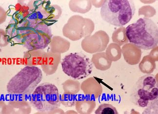 Researchers have discovered the double face of epigenetic protein EZH2 in delaying/growing of acute myeloid leukemia (AML)