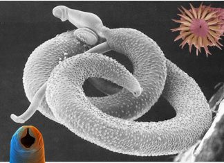 Parasit worms inside the human body cause cancer