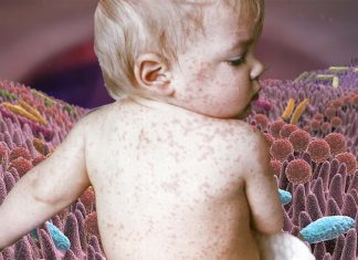 In newborn infants immune response is generated when solid food is introduced and microbiota expands