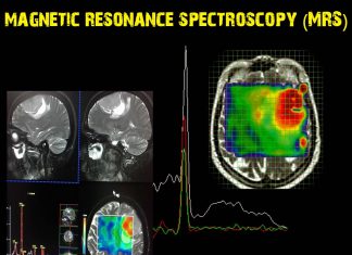 Researchers use MRS to measure individual metabolites in the brain to detect memory problems