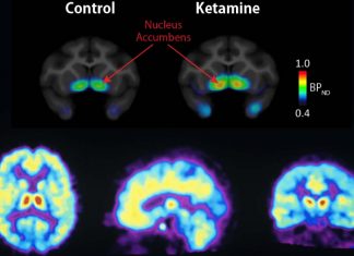 Researchers have discovered a crucial receptor that is critical to the mechanism of fast-acting antidepressants such as ketamine