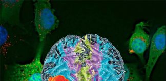 Researchers have discovered a new compound to treat glioblastome
