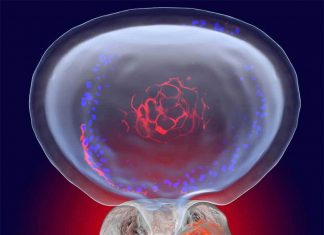The mysterious LY6D molecule linked with aggressive prostate cancer