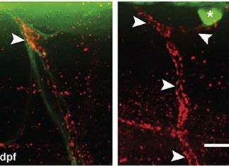 A damaged peripheral nervous system is capable of repairing itself recruiting healthy cell