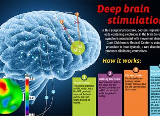 Deep stimulation improves cognitive control in psychiatric disorders by augmenting brain rhythms